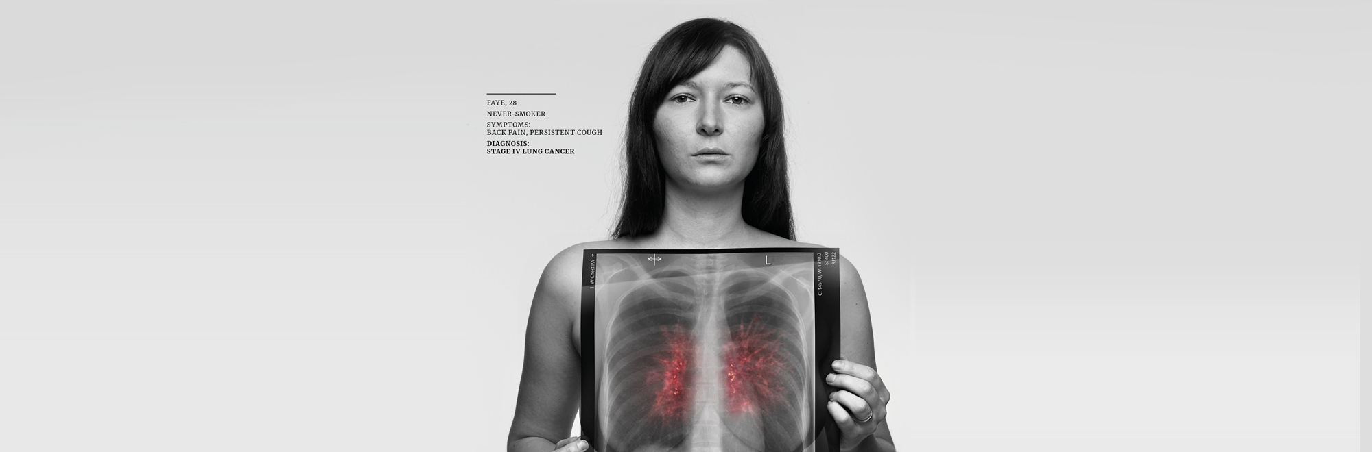 Engine Creative and Rankin raise awareness of lung cancer in never-smokers motivated by their personal stories