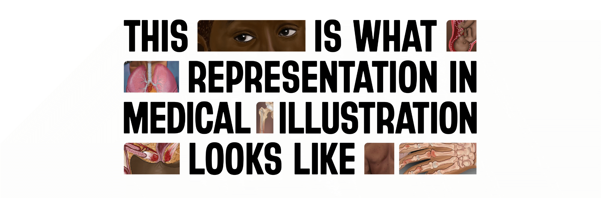 Illustrate Change: Drawing attention to the lack of diversity in medical imagery and disparities in the healthcare system