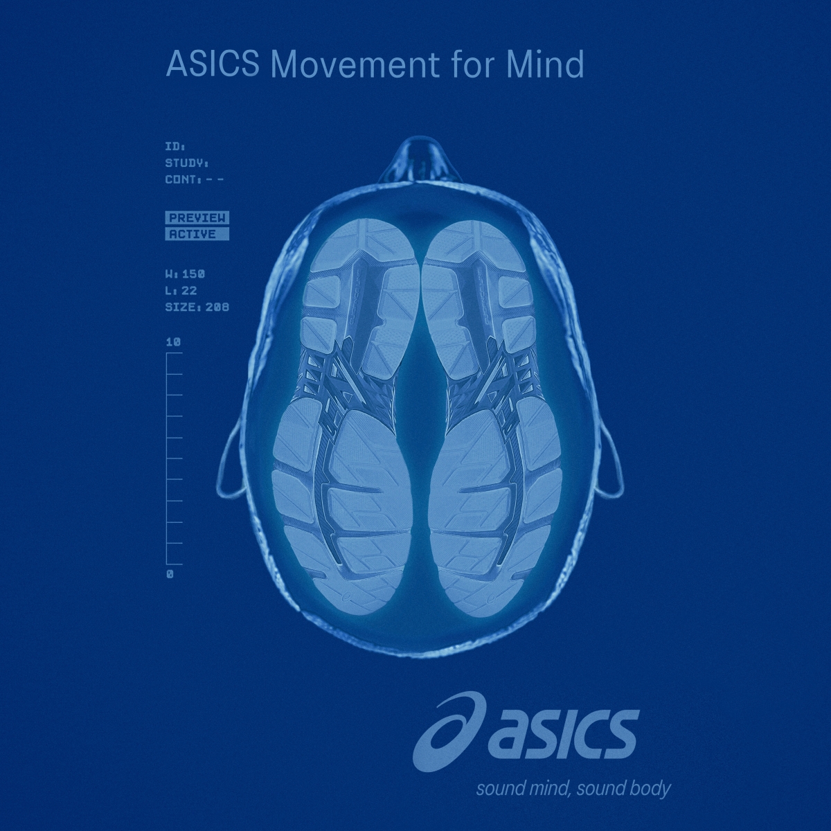 NDCO ASICS MRI